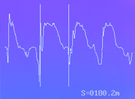 XHGG501Bæ³¢å½¢åææ¾ç¤º